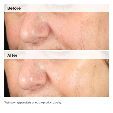 The Ordinary Alpha Arbutin 2% + HA - 30ml - (Renewed Formula)