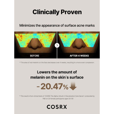 COSRX The Alpha-Arbutin 2 Discoloration Care Serum