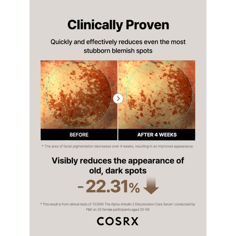COSRX The Alpha-Arbutin 2 Discoloration Care Serum