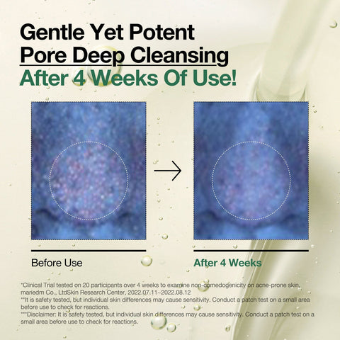 Anua Heartleaf Double Cleansing – Bundle Offer