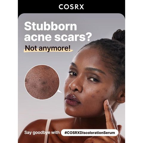 COSRX The Alpha-Arbutin 2 Discoloration Care Serum