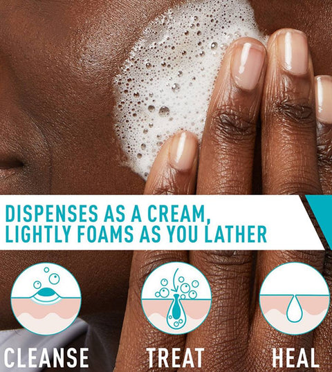 CeraVe Acne Foaming Cream Cleanser - 150ml