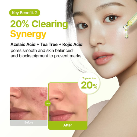 Purito Seoul Azelaic Acid 10 Kojic Tea Tree Serum 30ml