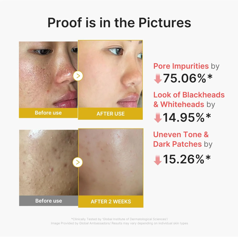 Medicube Kojic Acid Turmeric Peel Shot 80ml