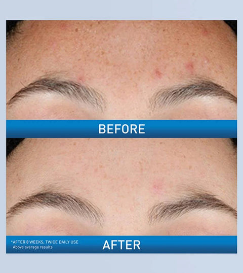 CeraVe Resurfacing Retinol Serum – 30ml